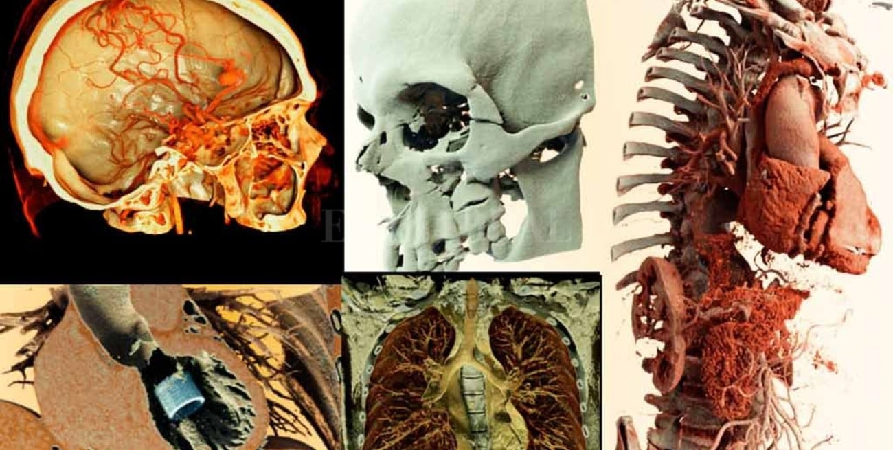 Imágenes 3D e Inteligencia Artificial: herramientas para un mejor diagnóstico 
