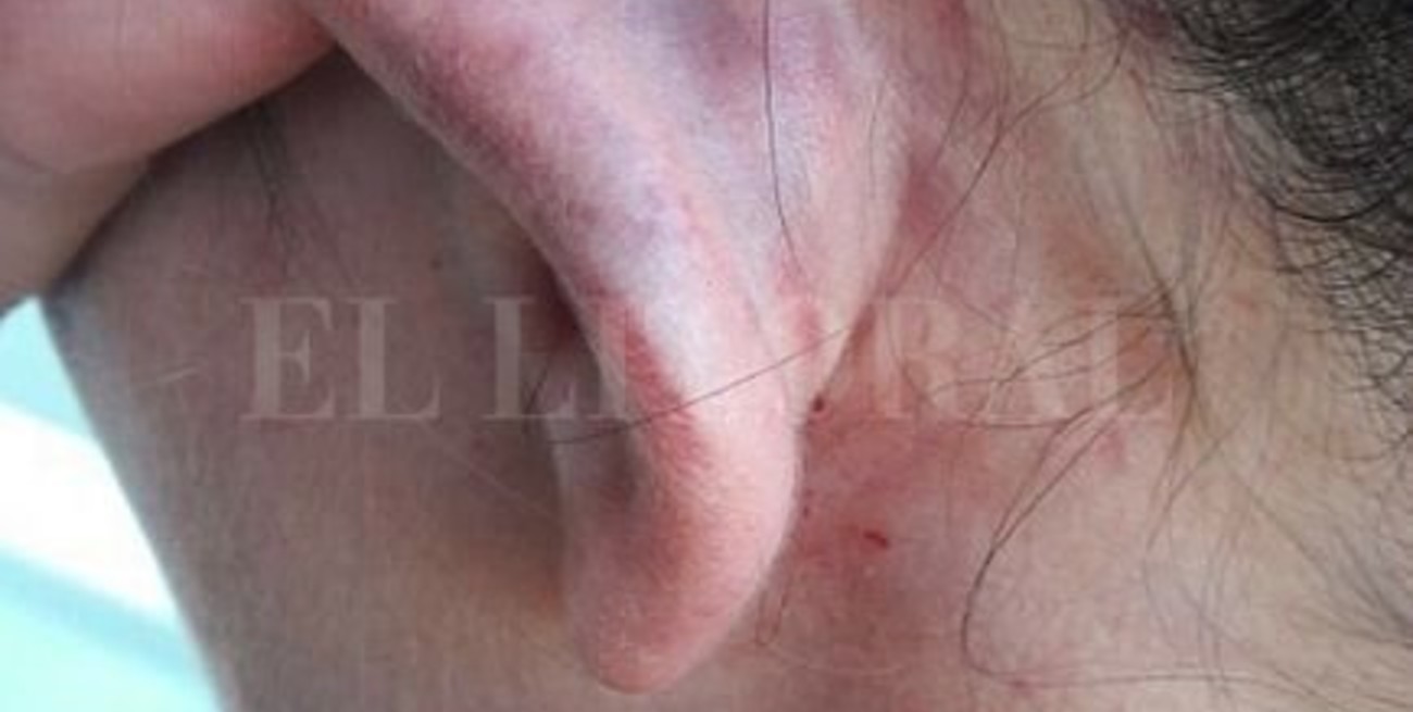 Denuncian a un rugbier por golpear a su novia