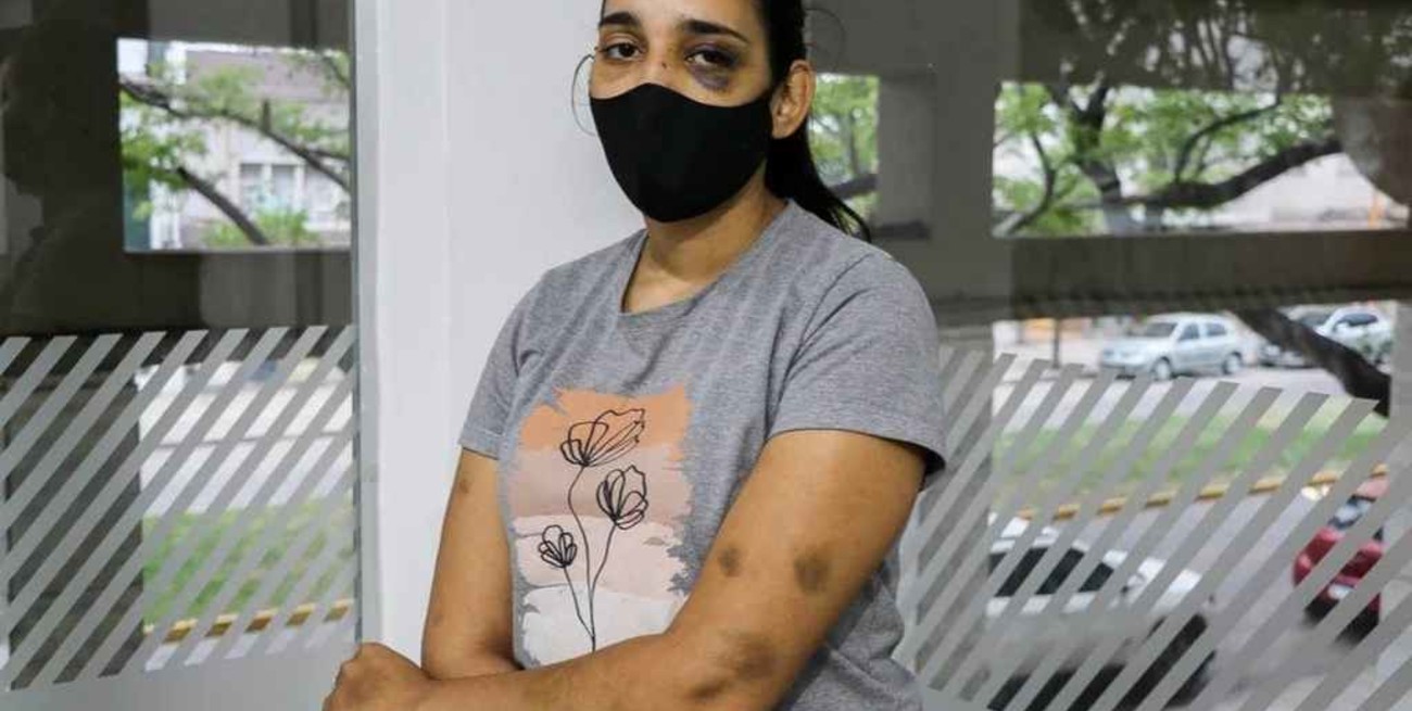 "Me pegaron a matar": la denuncia de una mujer en Córdoba atacada en un boliche y en la vía pública 
