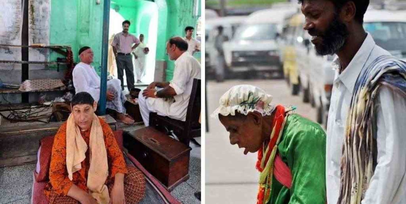 El drama de los "niños ratas" de Pakistán: menores con discapacidad obligados a mendigar en las calles