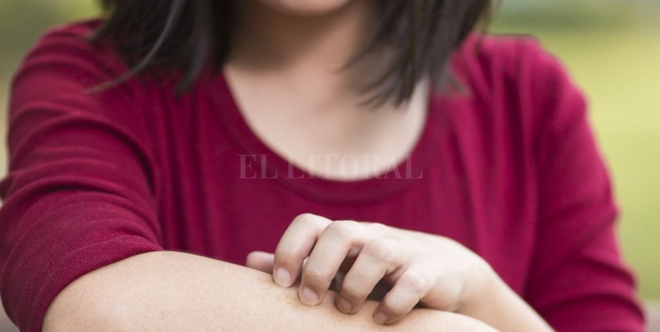 El picor que reclama mejor atención