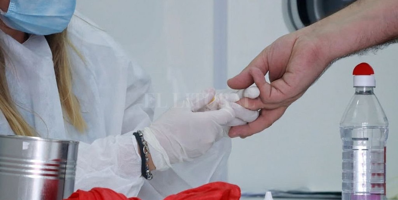 Pacientes con VIH tienen un 30% más de riesgo de desarrollar casos de coronavirus grave y crítico