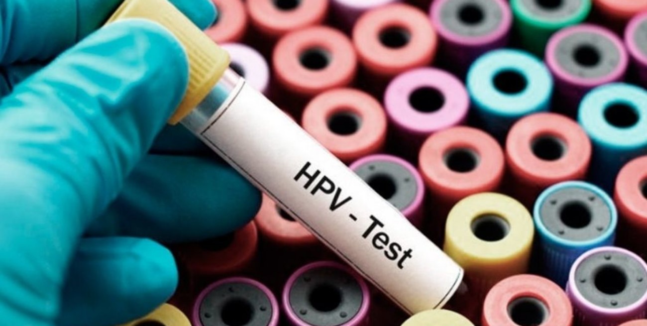 En Argentina mueren más de 2300 mujeres por el virus del papiloma humano