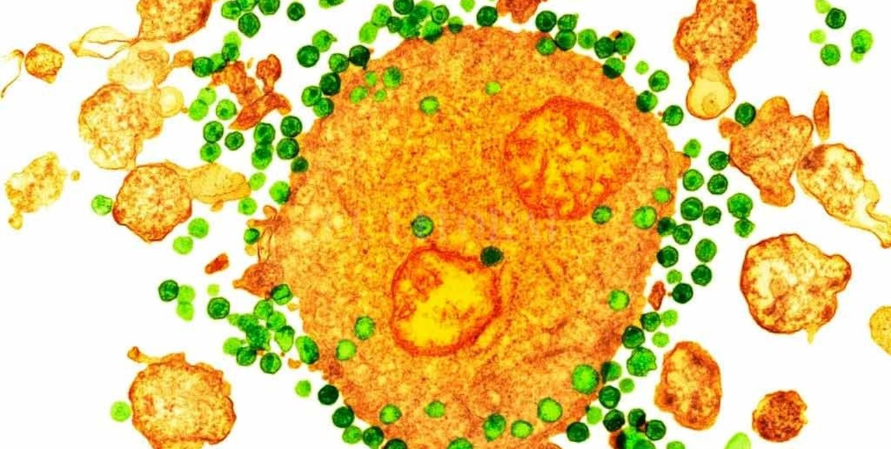 Científicos consideraron curada a una persona con VIH