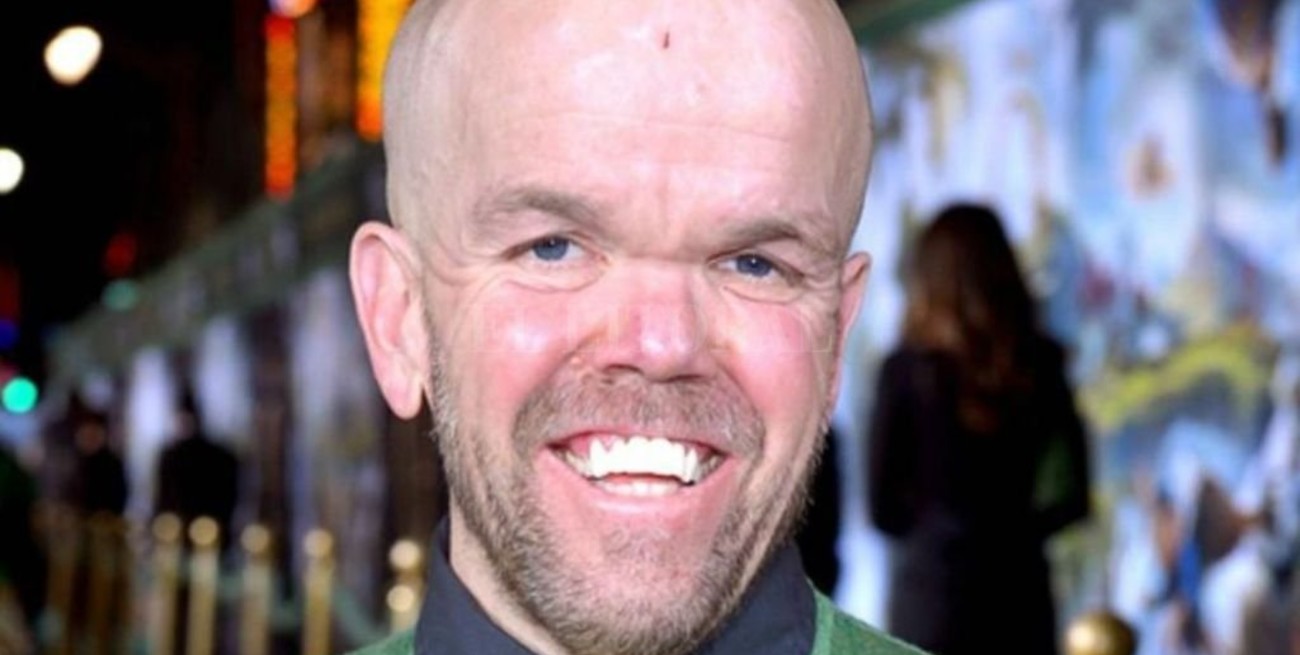 Falleció Stevie Lee, actor de Jackass y American Horror Story