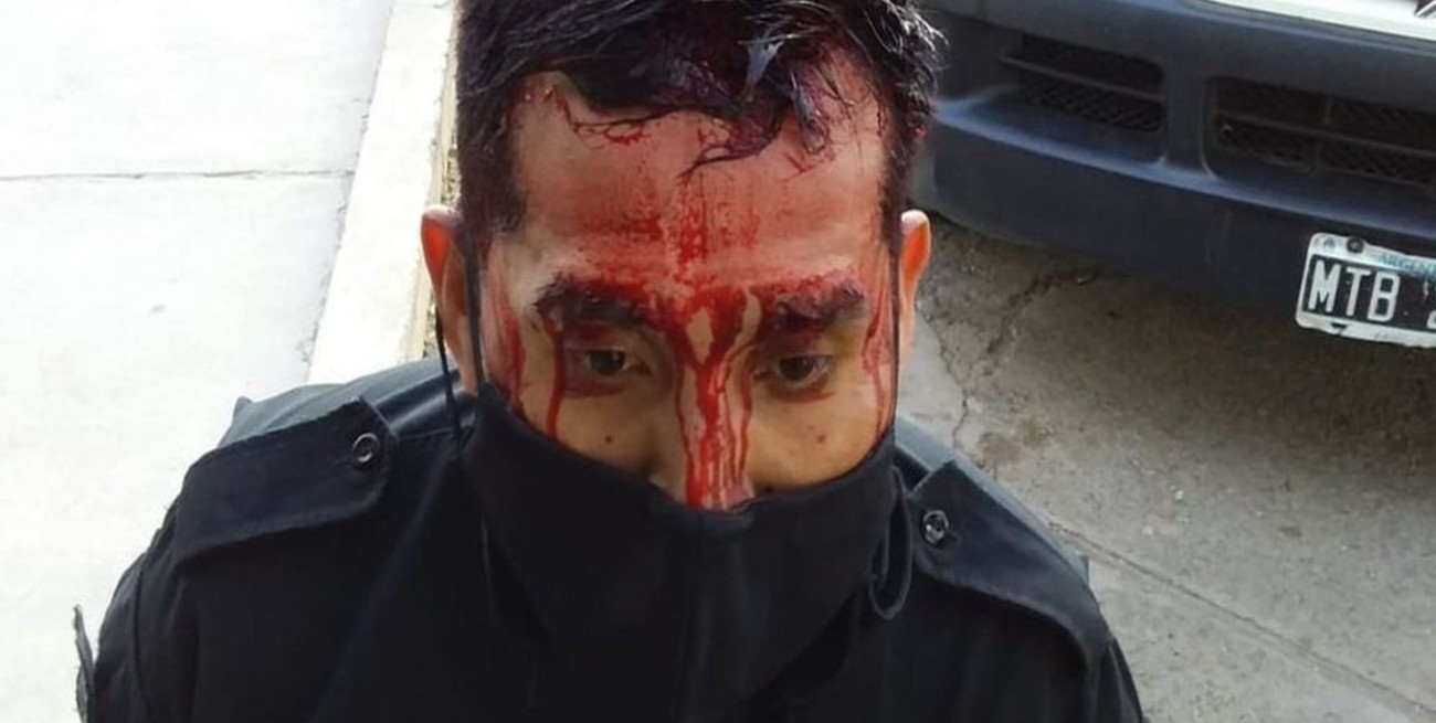 Salta: agredieron salvajemente a policías por intentar parar un partido de fútbol clandestino