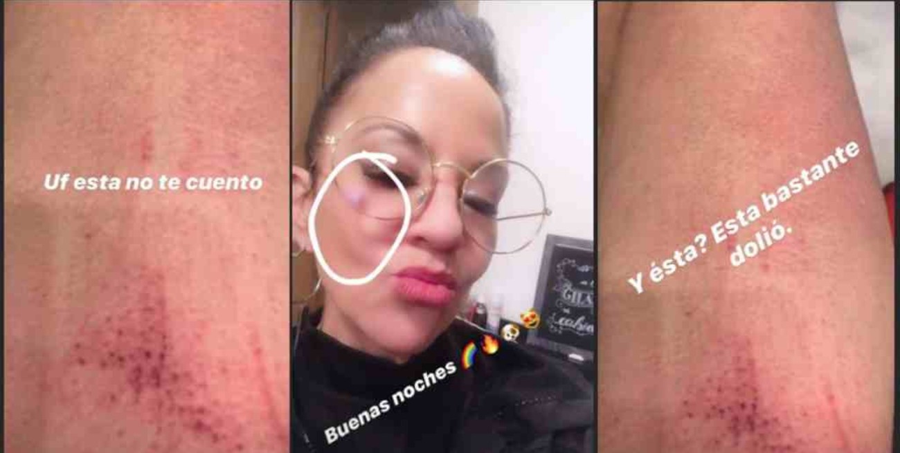 Miss Bolivia denunció públicamente a su ex marido por violencia de género