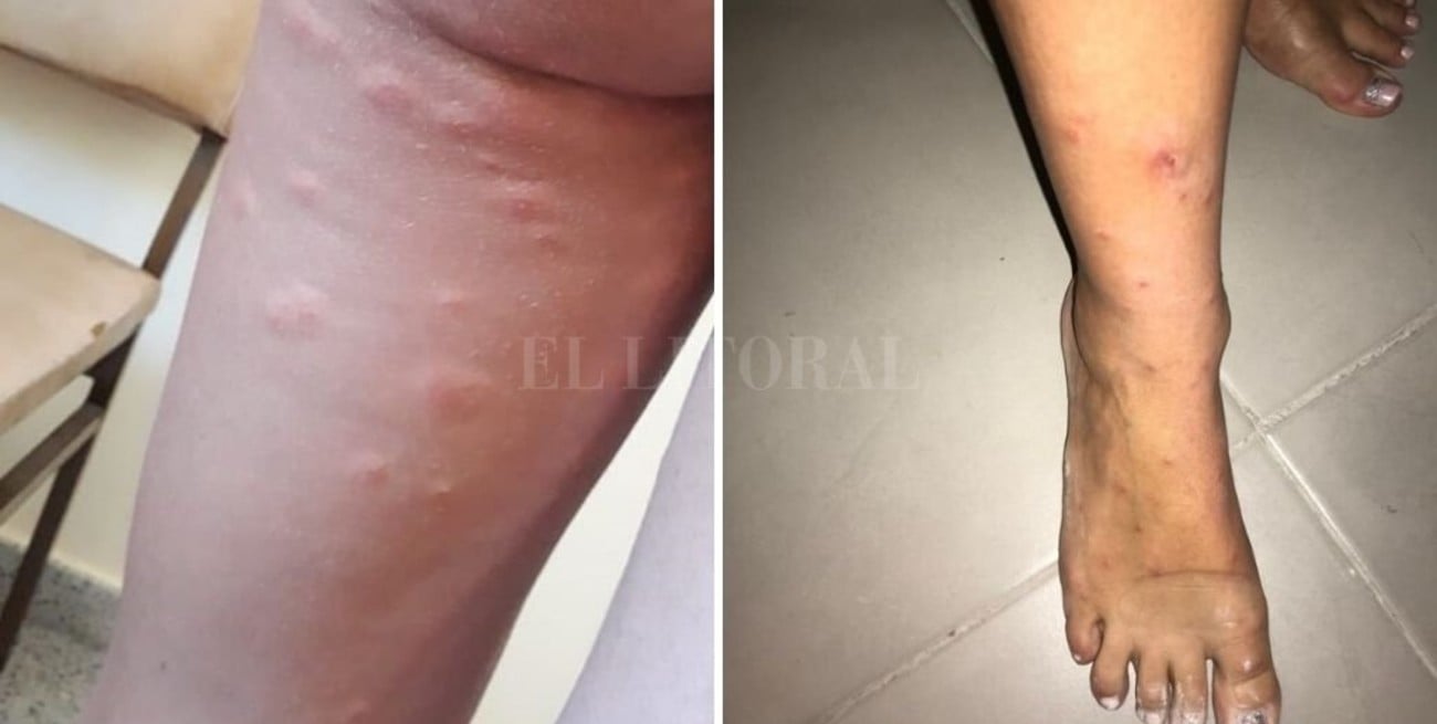 Atacada por moscas negras en la isla