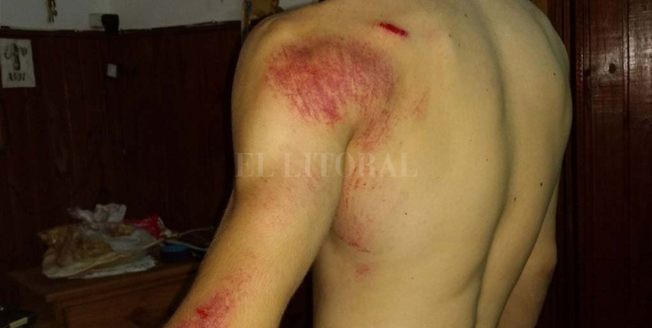 Pedaleaba por la costanera, no vió un bache y terminó con varios golpes