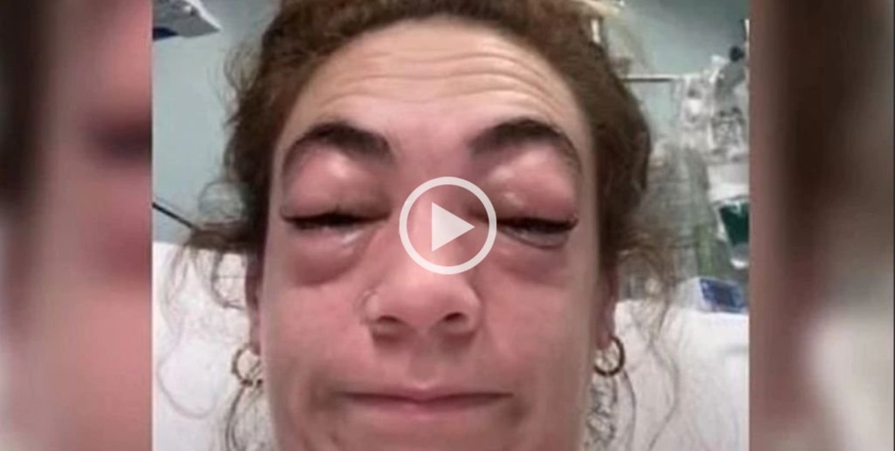 Video: las extensiones de pestañas le provocaron una alergia, terminó en el hospital y lo mostró en Tik Tok