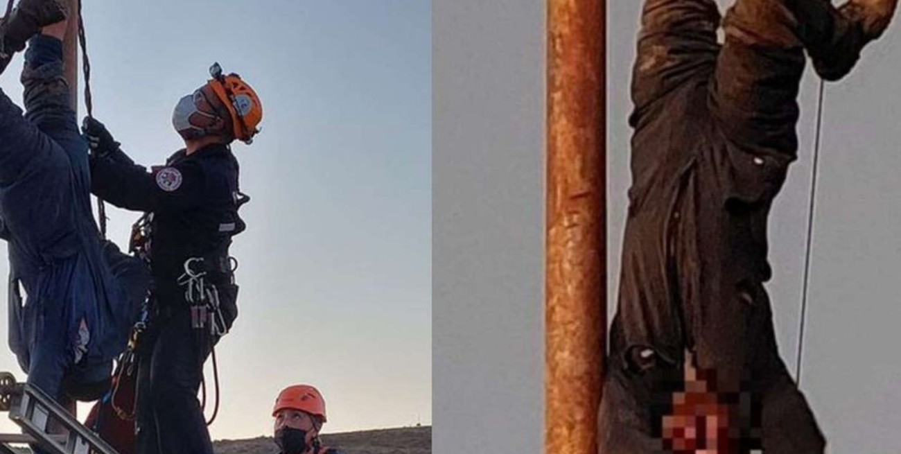 Le amputarán el brazo al hombre que salió a robar cables y quedó electrocutado en Chubut