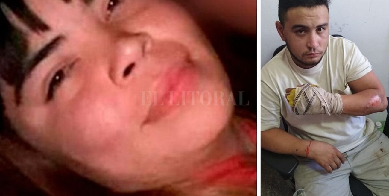 Murió la joven quemada por su pareja durante una discusión