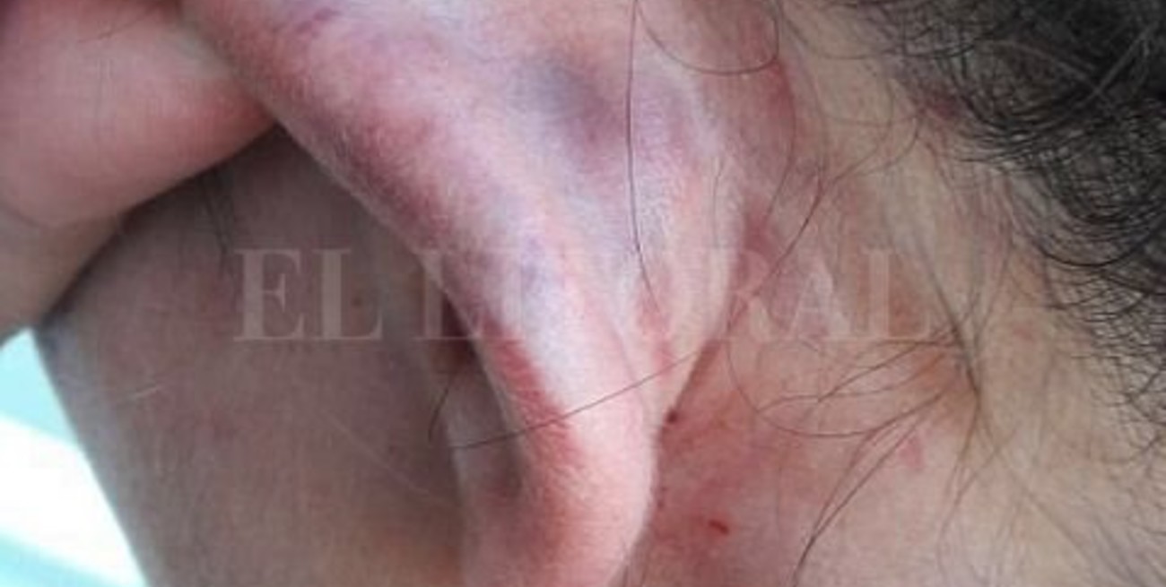 Un ex rugbier rosarino fue condenado por golpear a su novia, quien lo filmó y viralizó el video