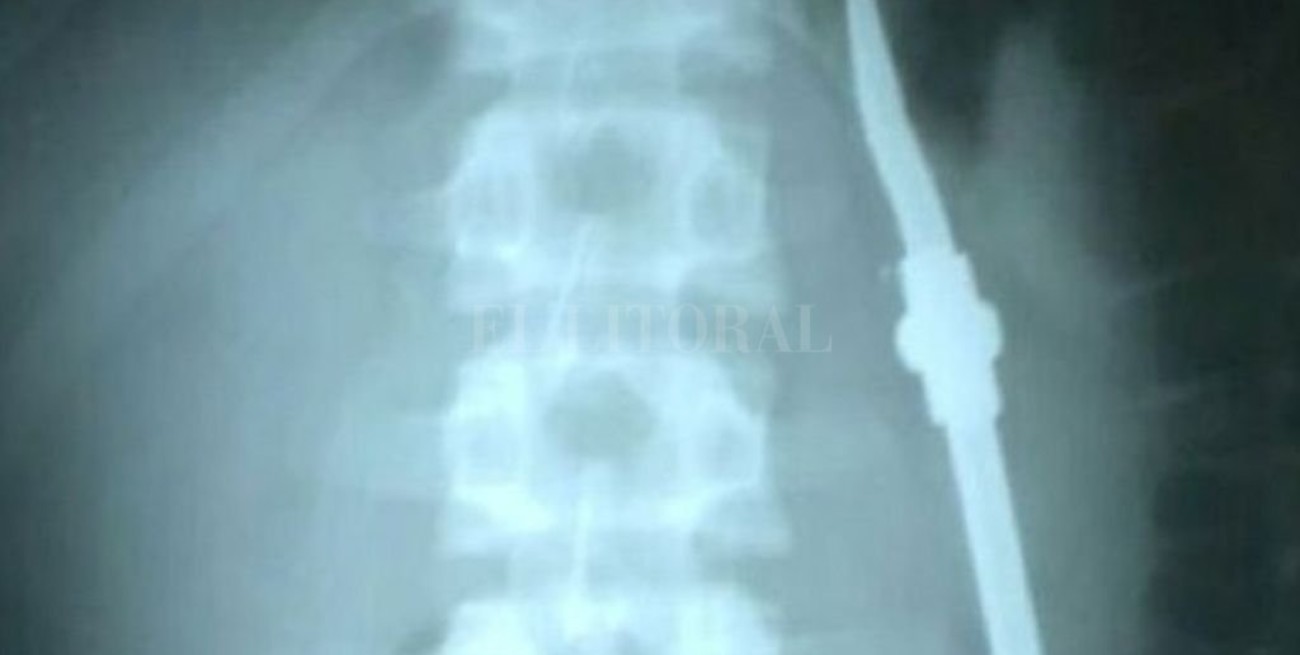 Paraná: una presa se tragó una bombilla