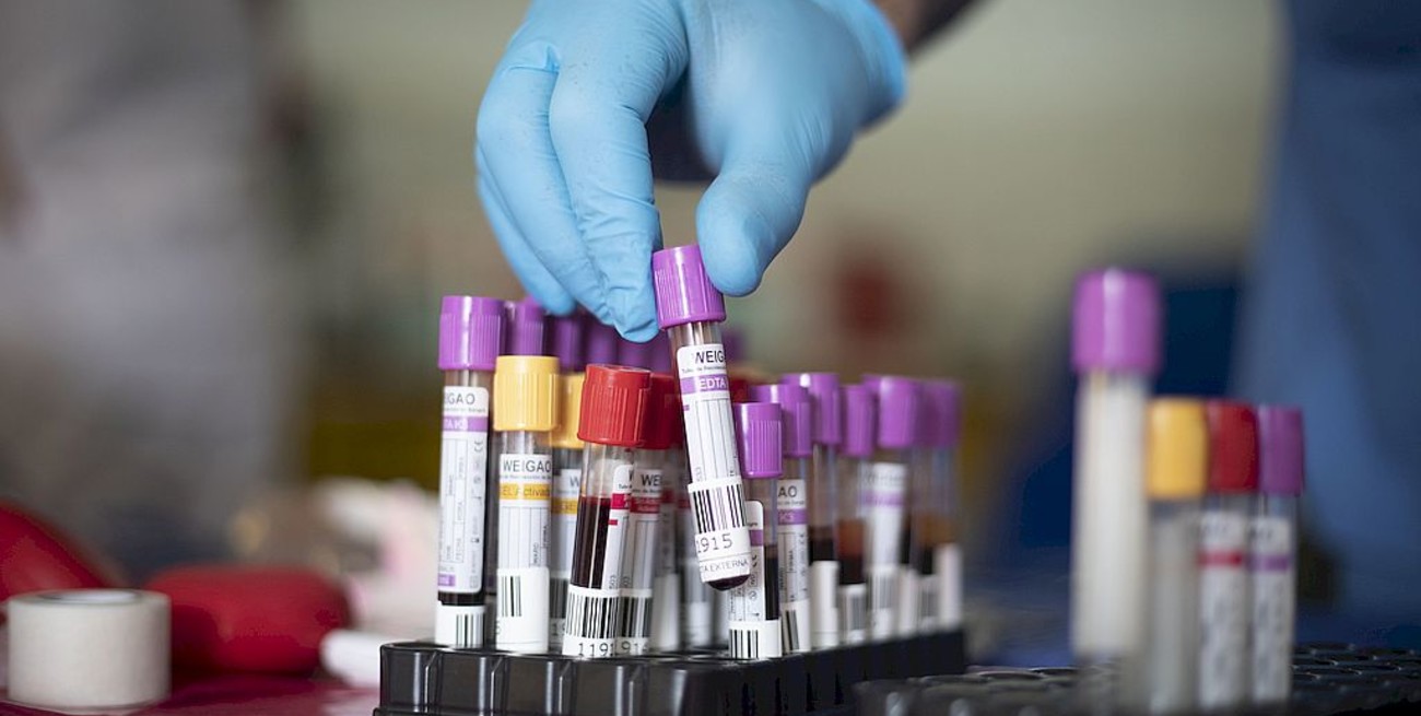 La circulación comunitaria superó a los casos de contagios en el exterior