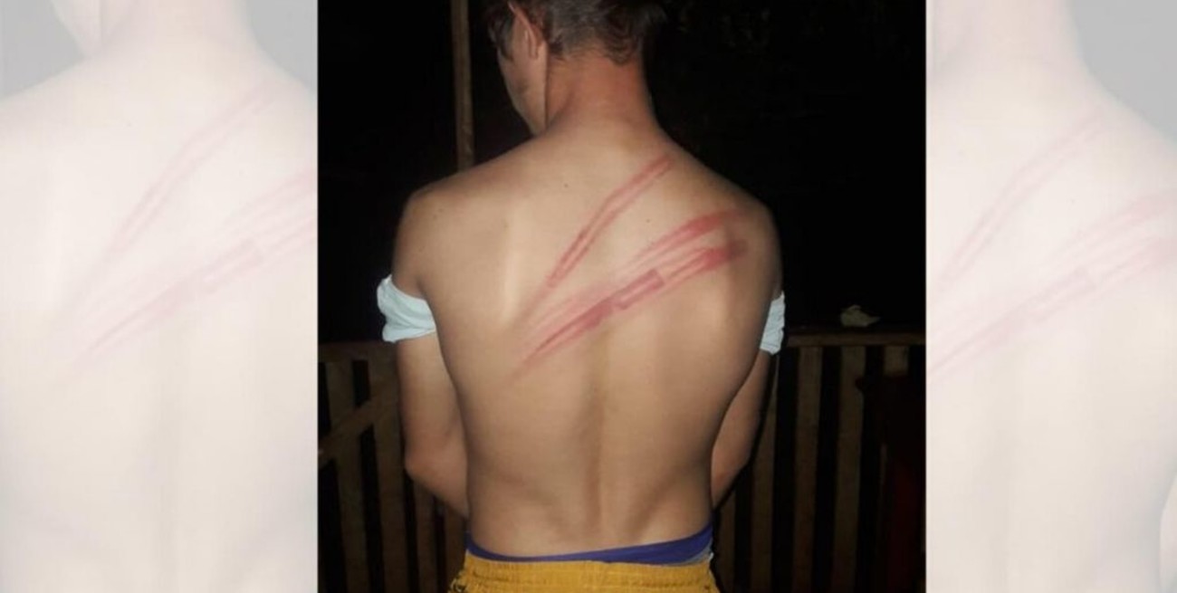 Siete policías de Misiones comenzaron a ser investigados por agresión a un joven