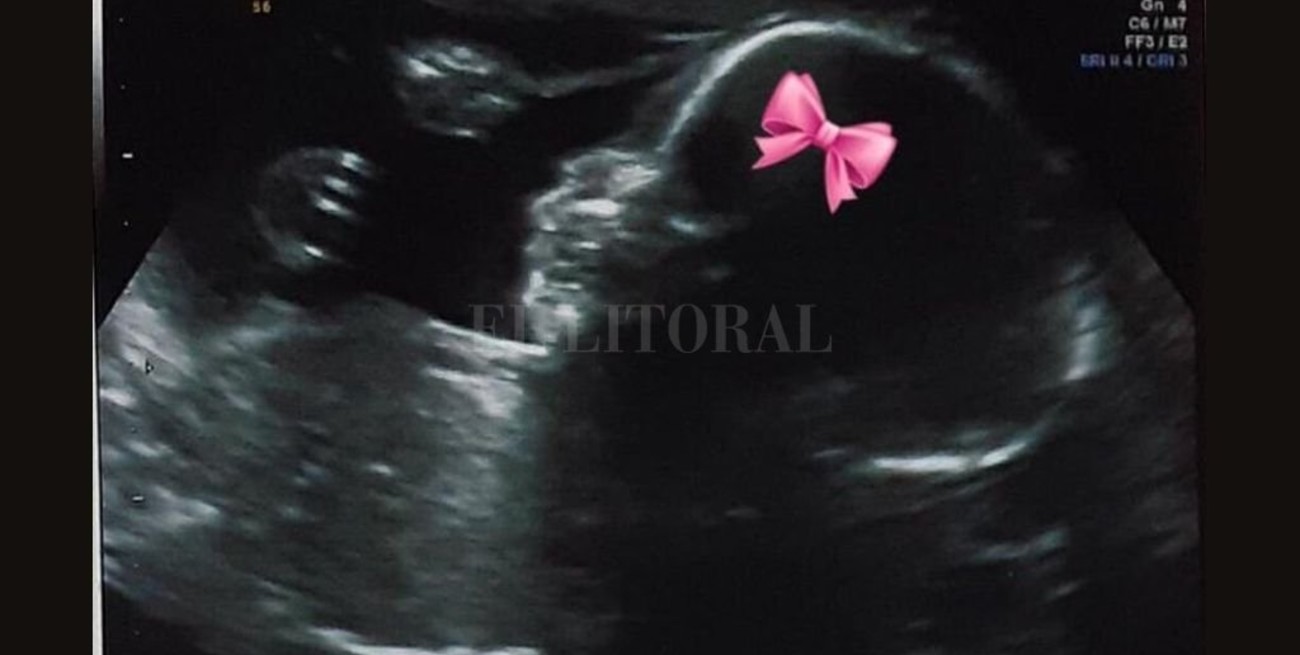 Tití Fernández anunció que espera una nieta y se llamará "Sol"