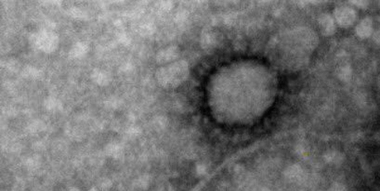 Difunden la primera foto del coronavirus que circula en Argentina