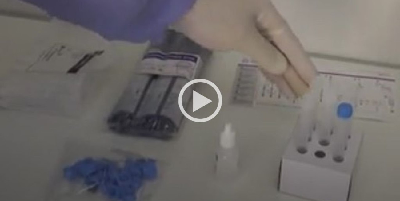 Coronavirus: especialistas locales explicaron cómo funcionan los test "rápidos"