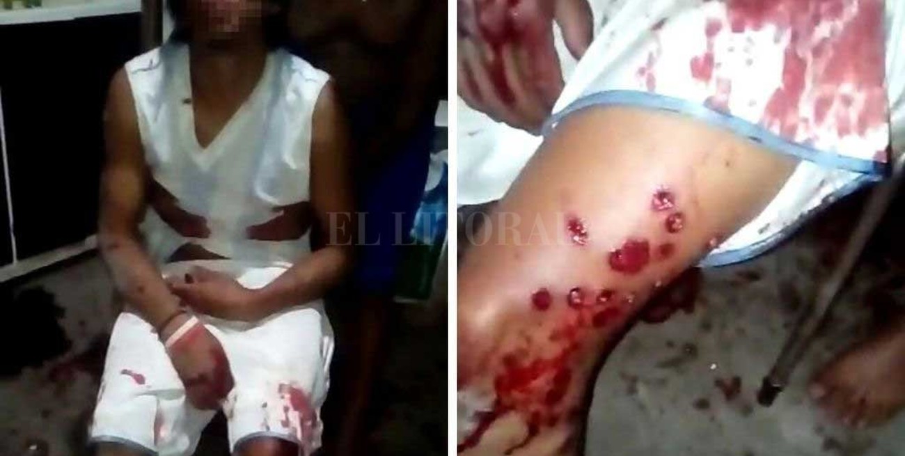 Fueron a pedir que bajen la   música y los apedrearon