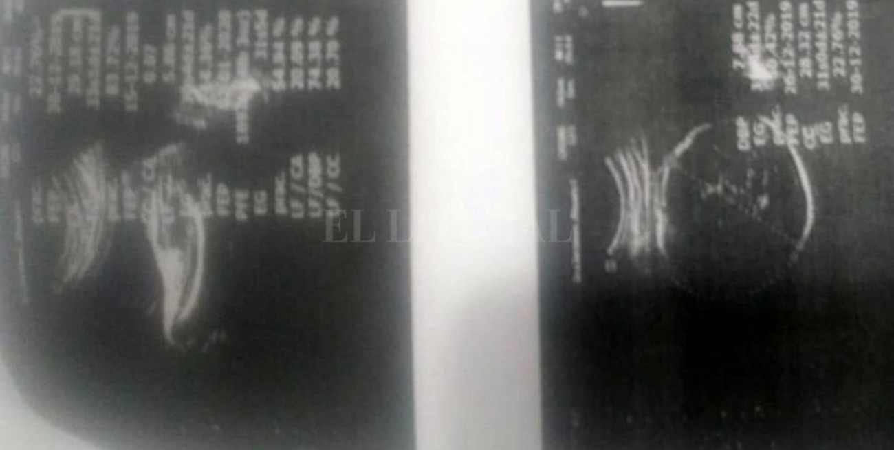 Investigan irregularidades tras el nacimiento de un bebé con dos cabezas