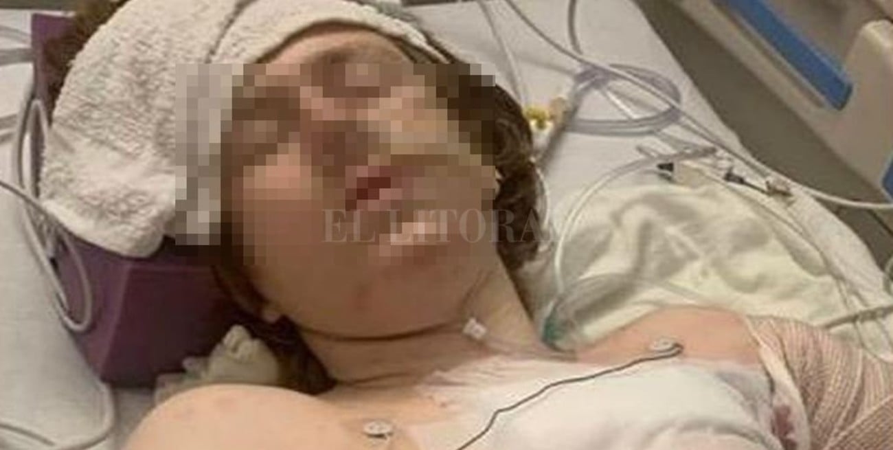 Estados Unidos: la policía le disparó a un joven con autismo mientras sufría una crisis