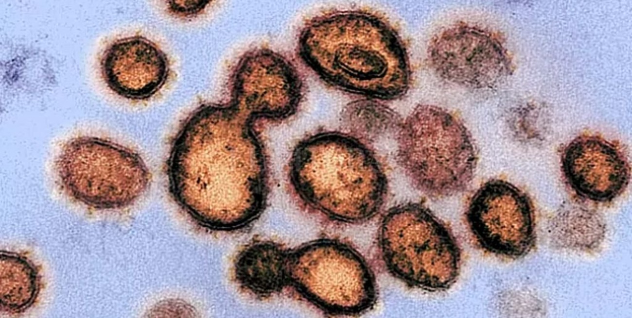 Ya circulan dos cepas diferentes del coronavirus 