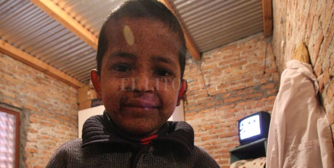 La llegada del diagnóstico 