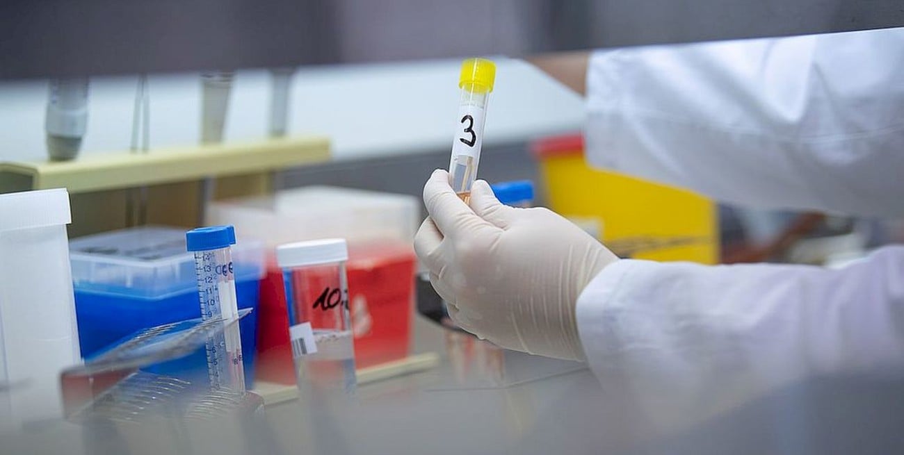 El Instituto Malbrán identificó tres cepas diferentes del Covid-19 que circulan en la Argentina