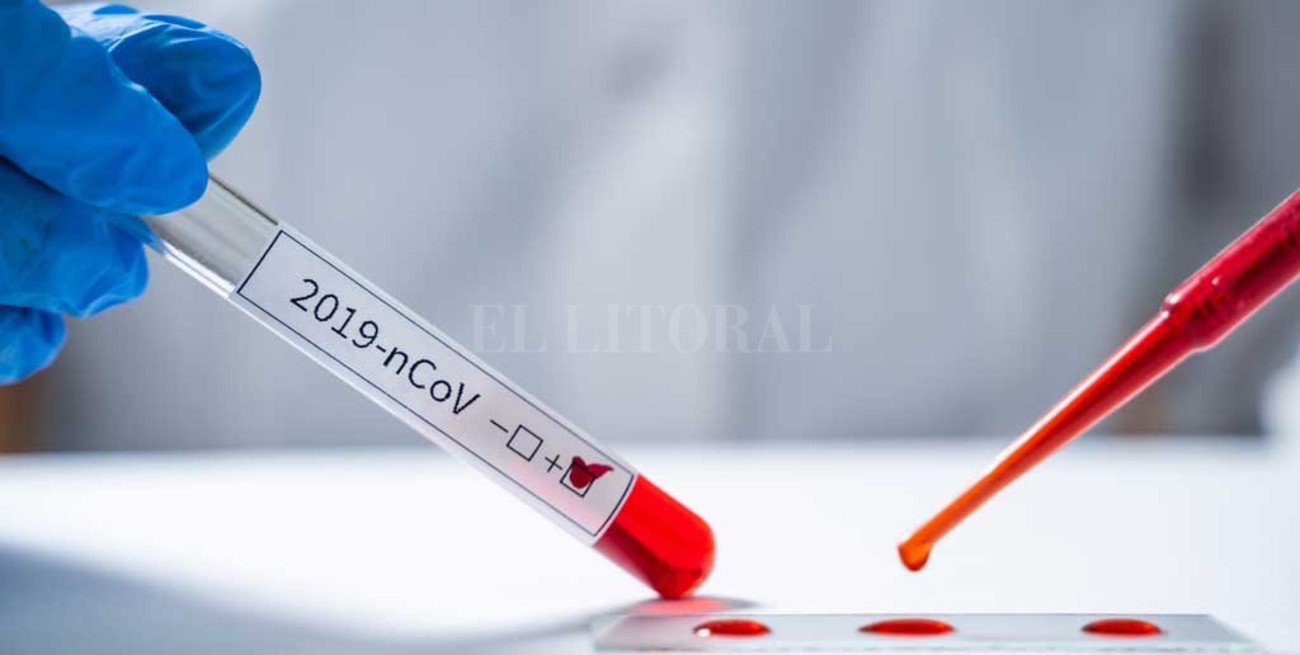 Se eleva a 70 la cifra de fallecidos por coronavirus en Argentina