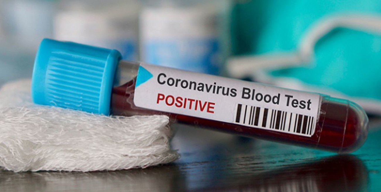 Confirmaron los primeros cuatro casos de coronavirus en Uruguay