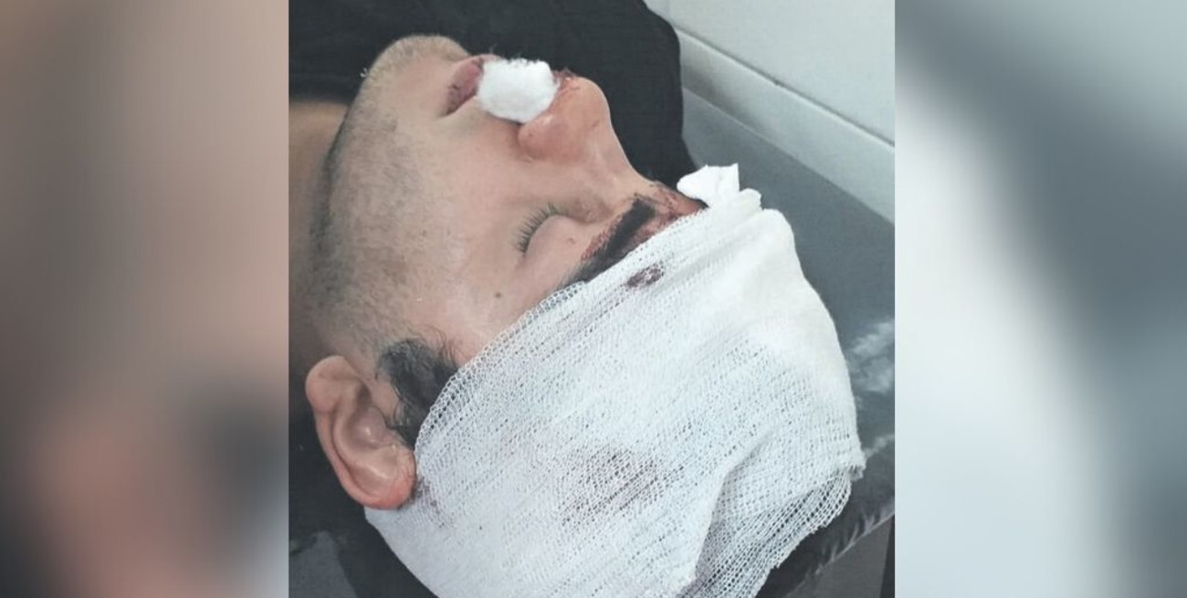 Internan a un joven con fractura de cráneo tras ser golpeado por otros seis en un boliche de Tucumán