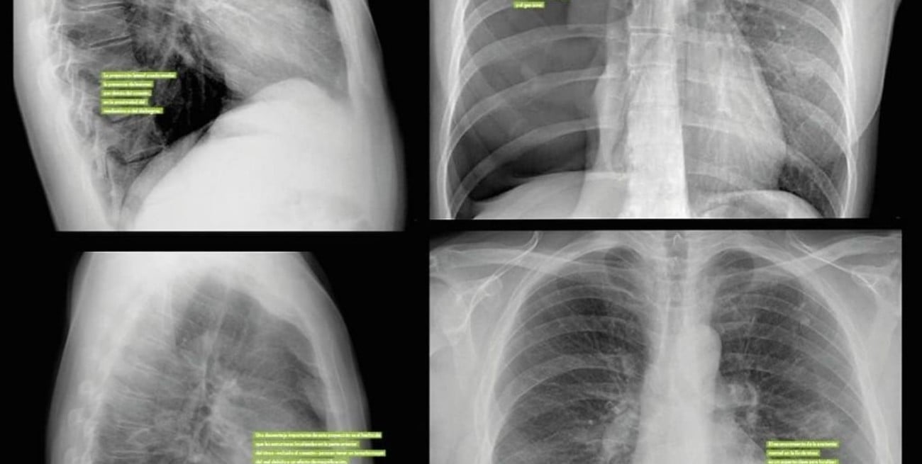 Crean una herramienta informática que transcribe informes de imágenes de estudios médicos