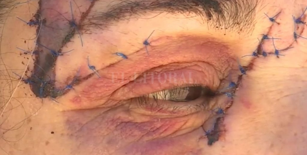 Australia: paseaba con su perro y los atacó un canguro