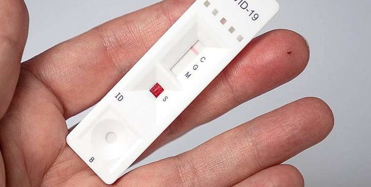 Advierten que el autotest de coronavirus puede dar falso negativo