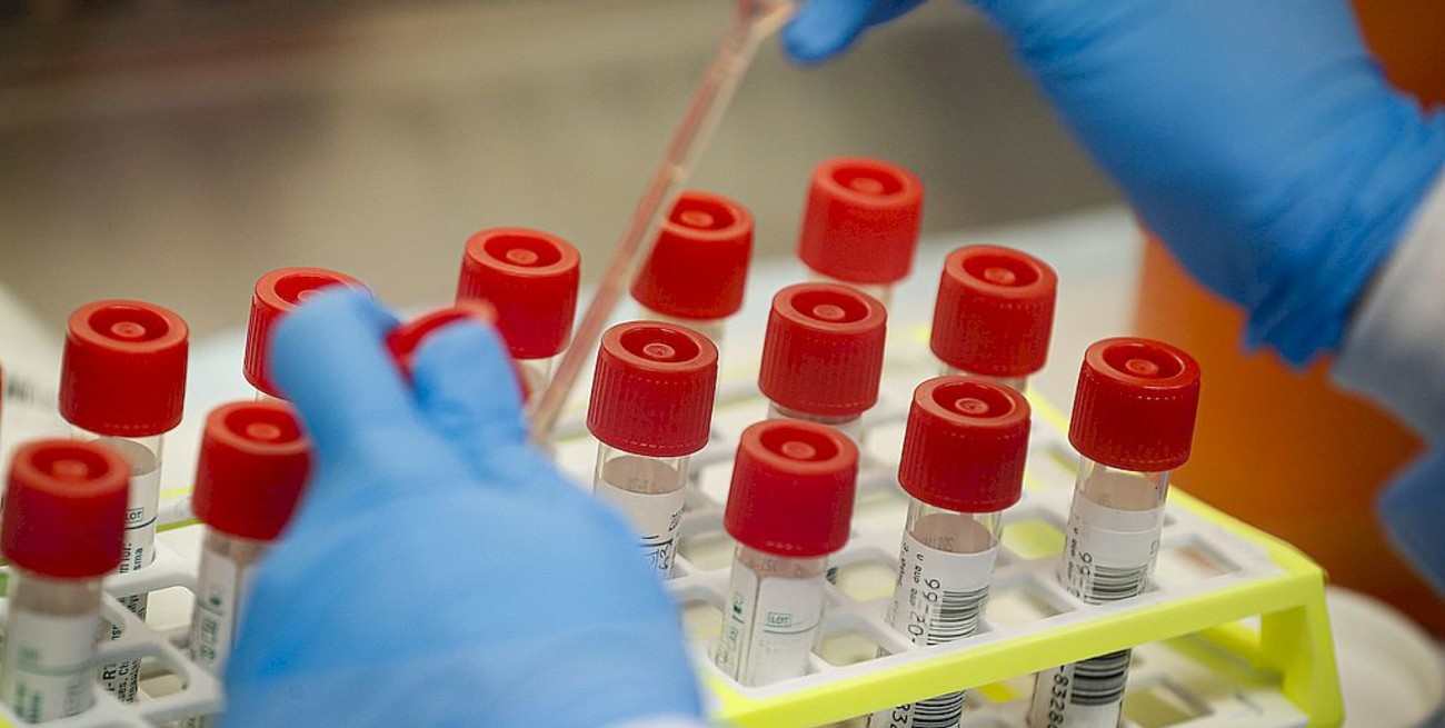 Coronavirus: dos muertos y 103 casos nuevos en el país