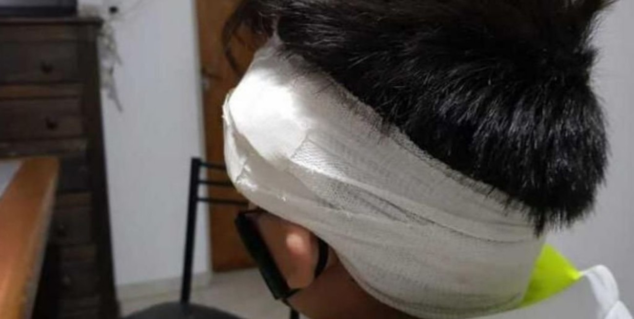 Un motociclista atropelló a un niño en Córdoba y se dio a la fuga