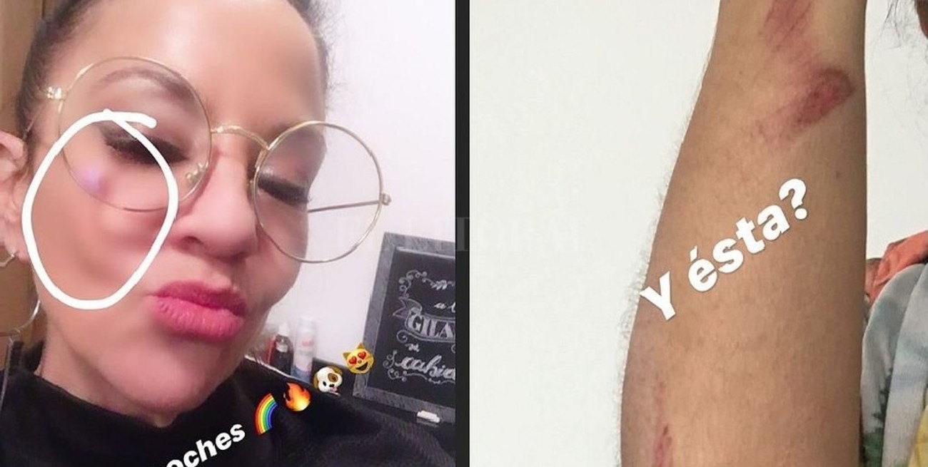 Justicia fija perimetral en favor de Miss Bolivia contra su ex pareja por violencia de género