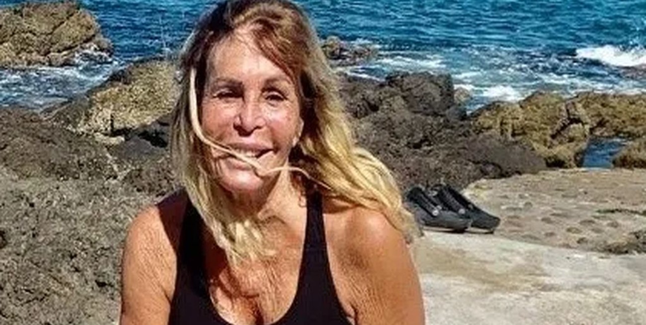 "Pata" Villanueva mostró una leve mejoría