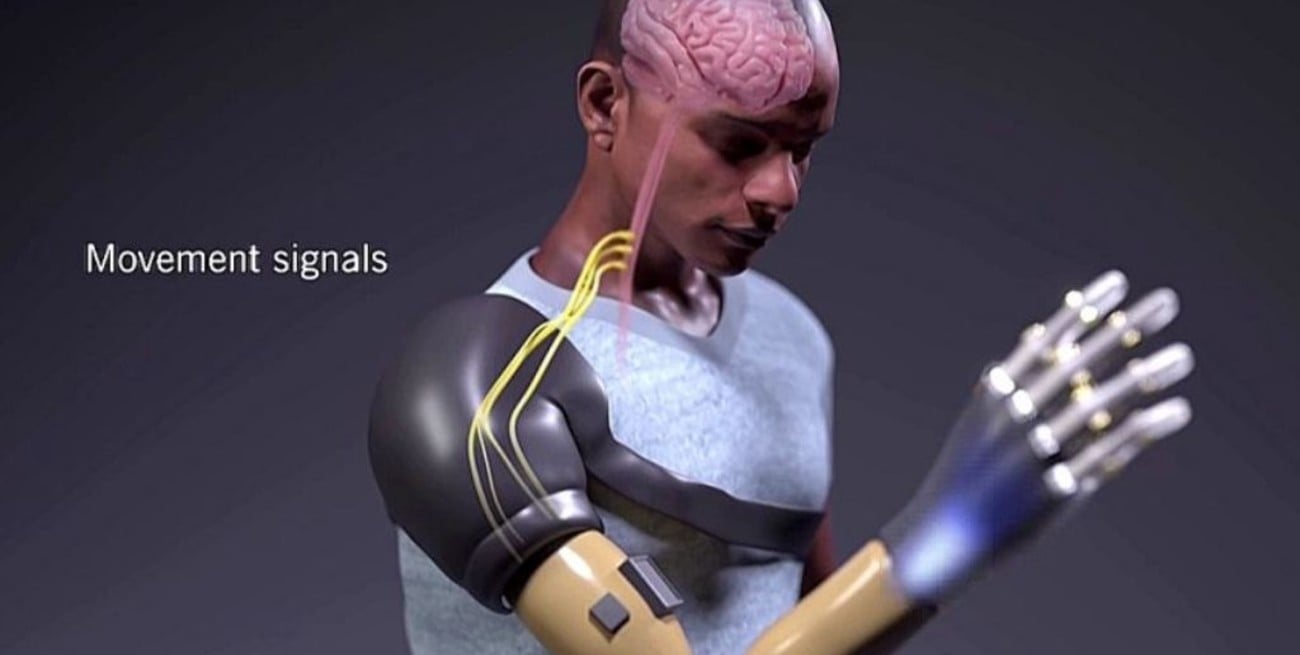 Científicos crean brazo biónico con sentido del tacto