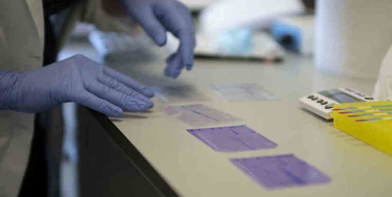 Covid-19: Francia prueba tests con resultados en 40 minutos y sin hisopos