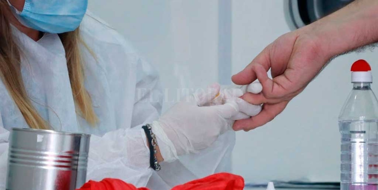 Dónde y por qué realizarse el test de VIH 