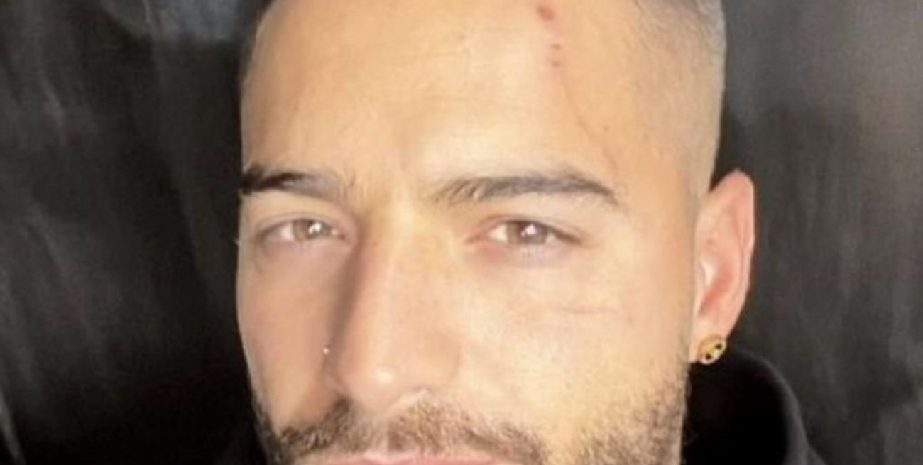 Maluma fue mordido en el rostro por su propio perro