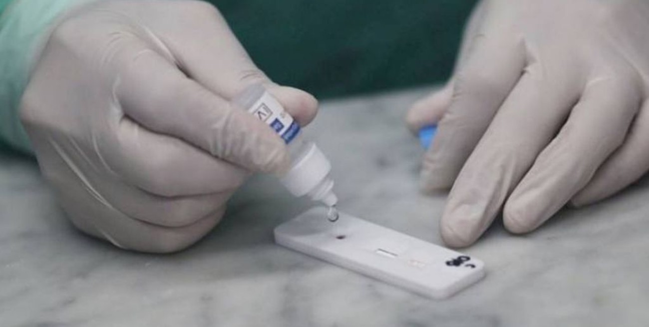 ANMAT prohibió un test de diagnóstico rápido de Covid