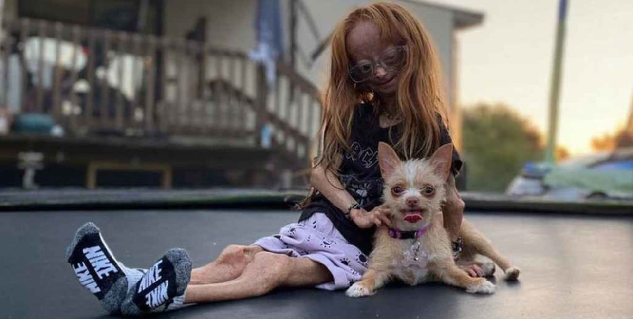 Murió Adalia Rose, la youtuber que inspiró la película de Benjamin Button