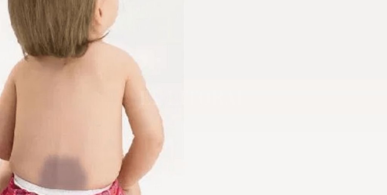 Las manchas azules, el dedo acusador