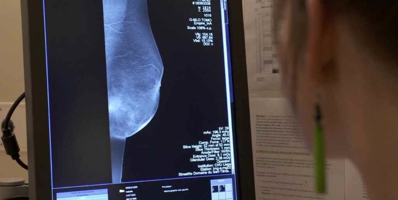 El Ministerio de Salud realizará acciones para prevenir y detectar distintos tipos de cáncer