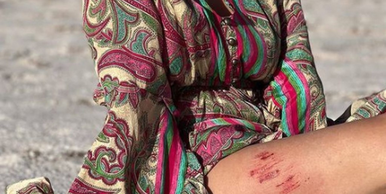 Doloroso accidente: a la China Suárez se la "tragó la tierra"