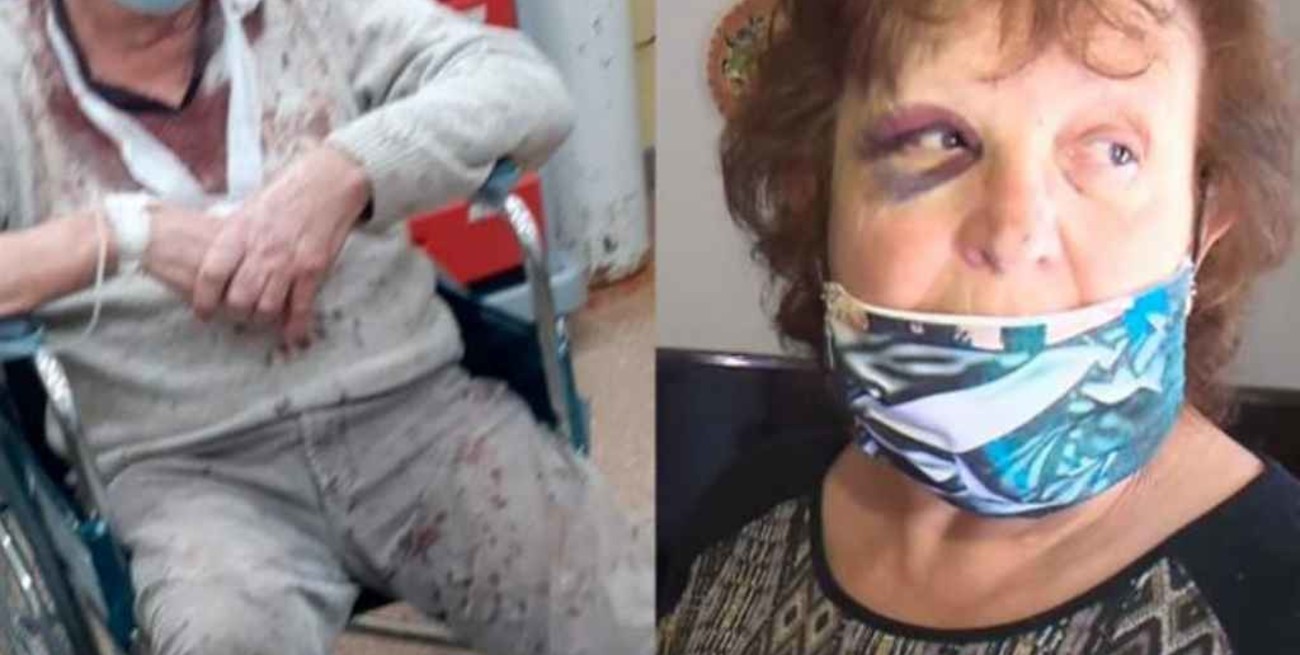 Picanas eléctricas y golpiza: brutal robo a un matrimonio de 70 años