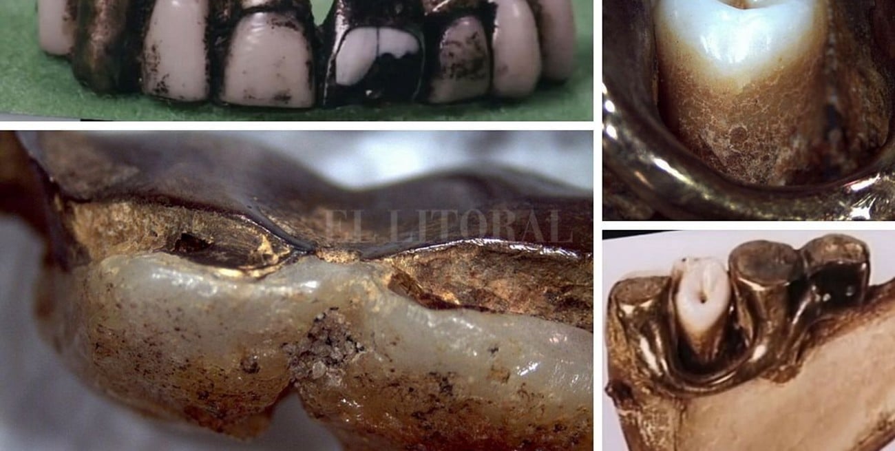 Forenses franceses aseguran haber hallado los restos de Hitler